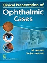 Clinical Presentation Of Opthalmic Cases (Pb2014)  By Agarwal M.L.