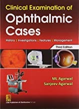 Clinical Examination Of Opthalmic Cases 3E (Pb 2022)  By Agarwal M.L