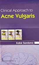 Clinical Approach To Acne Vulgaris (2015)  By Kabir Sardana