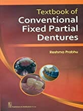Textbook Of Conventional Fixed Partial Dentures (Pb 2014) By Prabhu R.