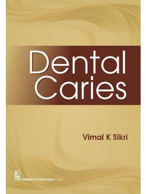 Dental Caries (Pb 2016) By Sikri V.K.