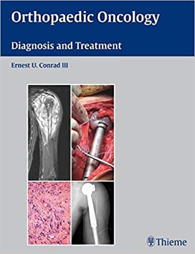 Orthopaedic Oncology By Conrad