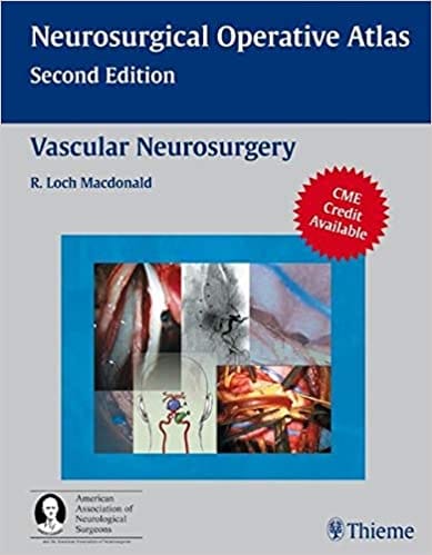 Vascular Neurosurgery By Macdonald