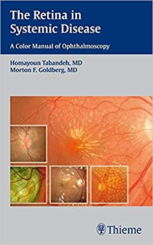 The Retina In Systemic Disease By Tabandeh