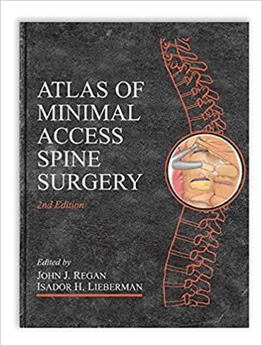 Atlas Of Minimal Access Spine Surgery, 2Nd Edition By Regan