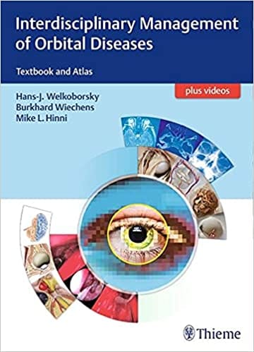 Interdisciplinary Management Of Orbital Diseases 1St Edition By Welkoborsky