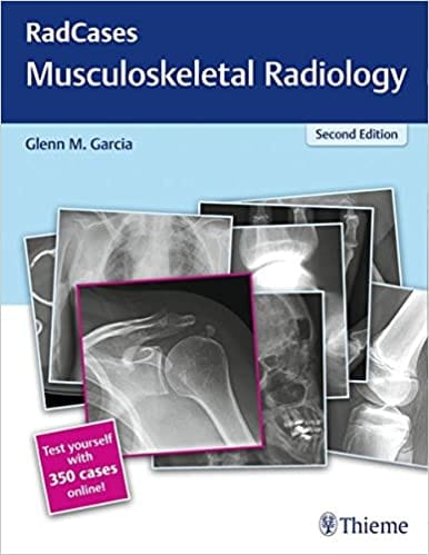 Radcases Musculoskeletal Radiology 2Nd Edition By GARCIA