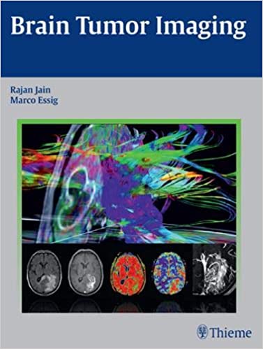 Brain Tumor Imaging 1St Ed. By Jain