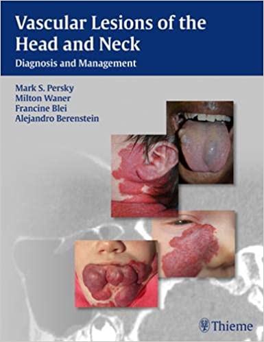 Vascular Lesions Of The Head And Neck By Persky