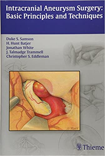 Intracranial Aneurysm Surgery By Samson