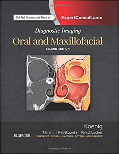 Diagnostic Imaging: Oral And Maxillofacial  - 2nd Edition By Koenig