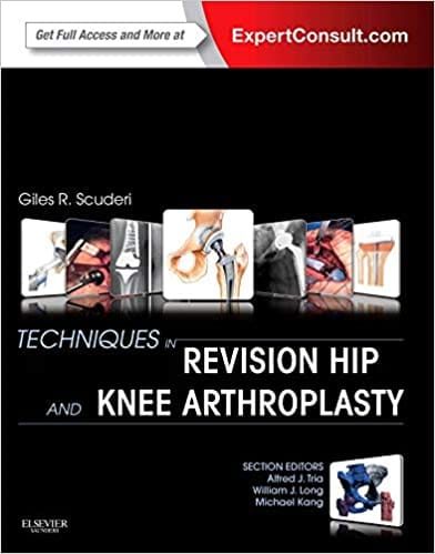 Techniques In Revision Hip& Knee Arthroplasty-1st Edition By Scuderi
