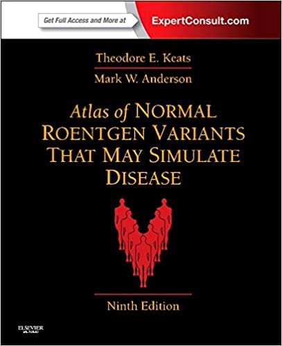 Atlas Of Normal Roentgen Variants 9 E By Keats