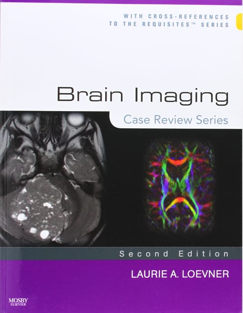 Brain Imaging- Case Review Series-2nd Edition By Loevner