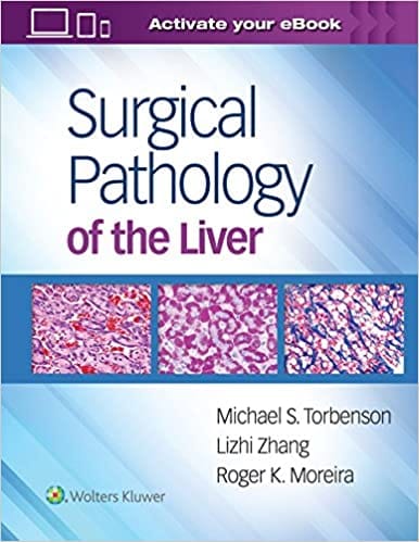 Surgical Pathology Of The Liver By ?Michael Torbenson MD