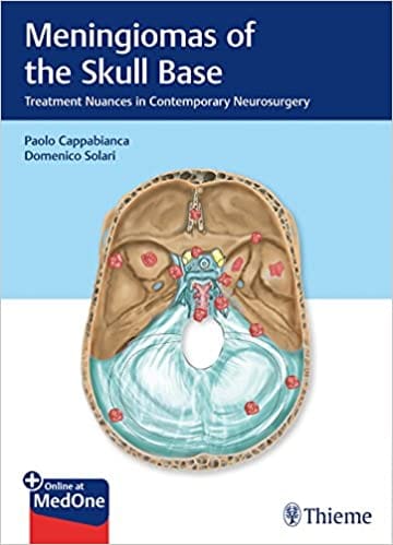 Meningiomas Of The Skull Base 1St Edition By Cappabianca