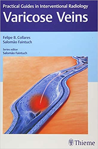 Varicose Veins Practical Guides In Interventional Radiology 1St Edition By Collares