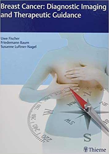Breast Cancer: Diagnostic Imaging And Therapeutic Guidance 1St Edition By Fischer