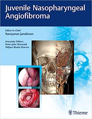 Juvenile Nasopharyngeal Angiofibroma 1St Edition By Janakiram