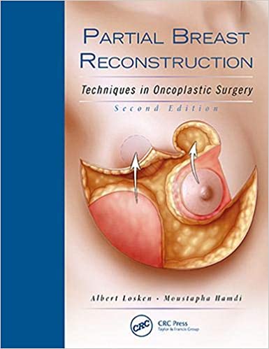 Partial Breast Reconstruction 2Nd Edition By Losken