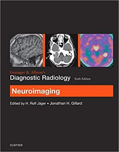 Grainger & Allison?S Diagnostic Radiology: Neuroimaging By Jager