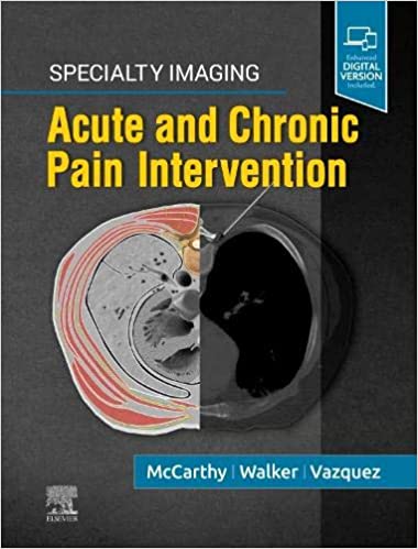 Specialty Imaging Acute And Chronic Pain Intervention By McCarthy