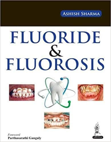 Fluoride & Fluorosis 1st Edition By Sharma Ashish