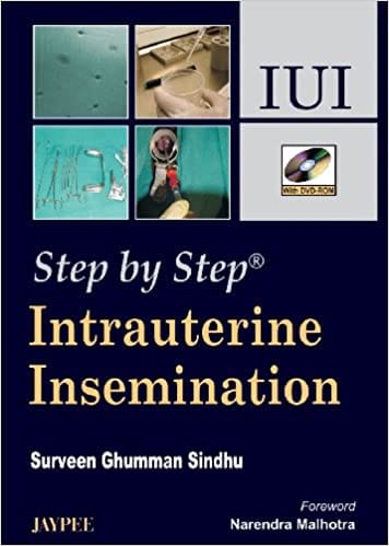 Step By Step Intrauterine Insemination Iui With Dvd-Rom 1st Edition By Sindhu