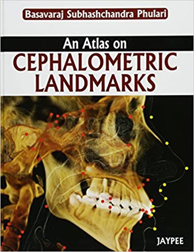 An Atlas On Cephalometric Landmarks 1st Edition By Phulari