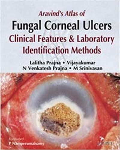 Aravind'S Atlas Of Fungal Corneal Ulcers Clinical Features & Lab.Identification Methods 1st Edition By Prajna