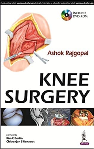 Knee Surgery Includes Dvd-Rom 1st Edition By Rajgopal Ashok