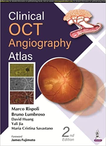 Clinical Oct Angiography Atlas 2nd Edition By Lumbroso Bruno