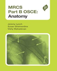 Mrcs Part B Osce:Anatomy 1st Edition By Lynch