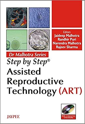 Step By Step Assisted Reproductive Technology Art With 2 Int.Dvd-Roms Dr.Malhotra Series 1st Edition By Malhotra