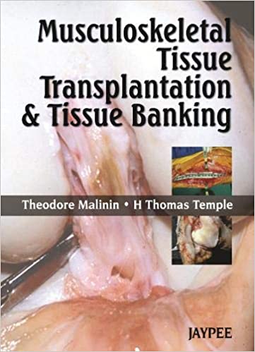 Musculoskeletal Tissue Transplantation & Tissue Banking 1st Edition By Malinin