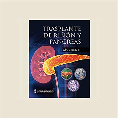Trasplante De Rinony Pancreas 1st Edition By Molment I