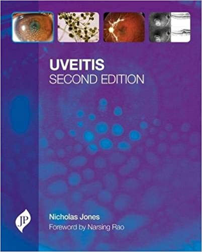 Uveitis With Cd-Rom 2nd Edition By Jones