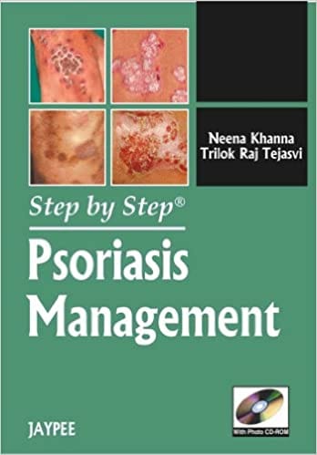 Step By Step Psoriasis Management With Photo Cd-Rom 1st Edition By Khanna