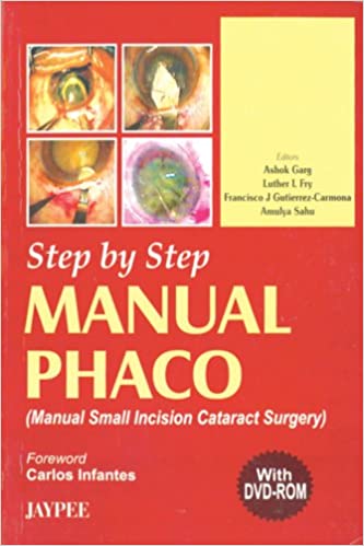 Step By Step Manual Phaco With Dvd-Rom 1st Edition By Garg