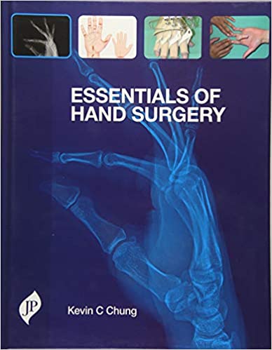 Essentials Of Hand Surgery 1st Edition By Chung Kevin C
