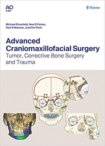 Advanced Craniomaxillofacial Surgery 1st Ed. 2020 By Ehrenfeld