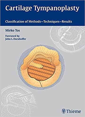 CARTILAGE TYMPANOPLASTY 2009 By MIRKO TOS