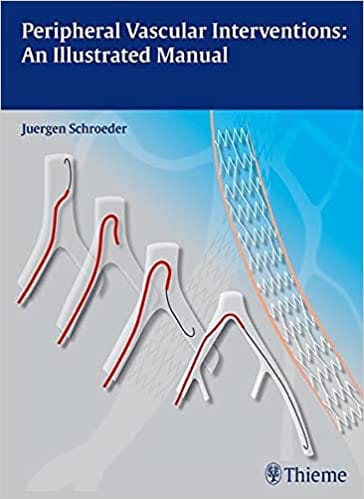 Peripheral Vascular Interventions An Illustrated M 2013 By Schroeder