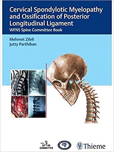 Cervical Spondylotic Myelopathy and OPLL 1st Ed. 2021 By Zileli