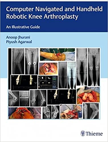 Computer Navigated and Hand Held Robotic Knee Arthroplasty: An Illustrative Guide 1/e 2021 By Jhurani