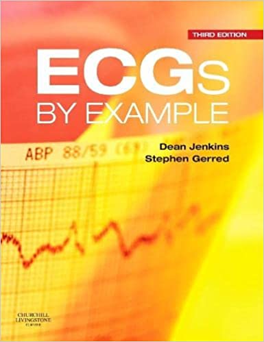 ECGs by Example-3rd EditionD 2011 By Jenkins