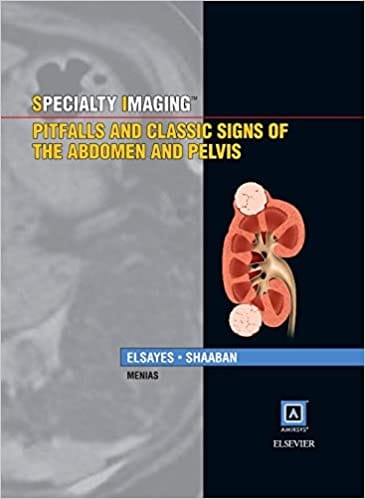 Specialty Imaging Pitfalls and Classic Signs of the Abdomen and Pelvis 2015 By Elsayes Publisher Elsevier