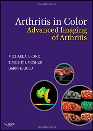 Arthritis in Color: Advanced Imaging of Arthritis 2009 By Bruno Publisher Elsevier