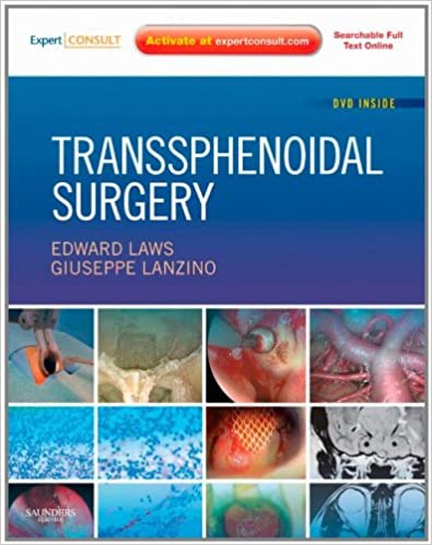 Transsphenoidal Surgery 2010 By Laws Publisher Elsevier