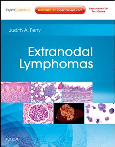 Extranodal Lymphomas 2011 By Ferry Publisher Elsevier